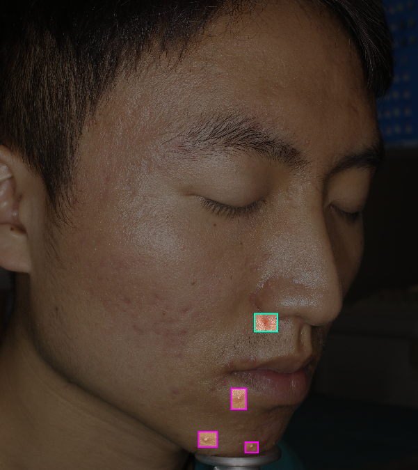 Acme Dermatology Initiative